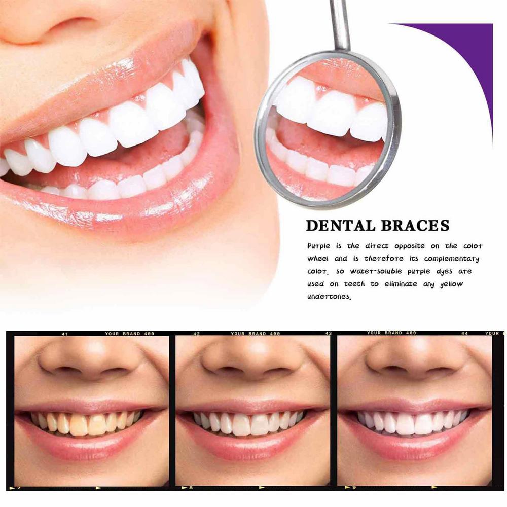 Purple Toothpaste - Say Goodbye to Yellow Stains! Hello White Teeth